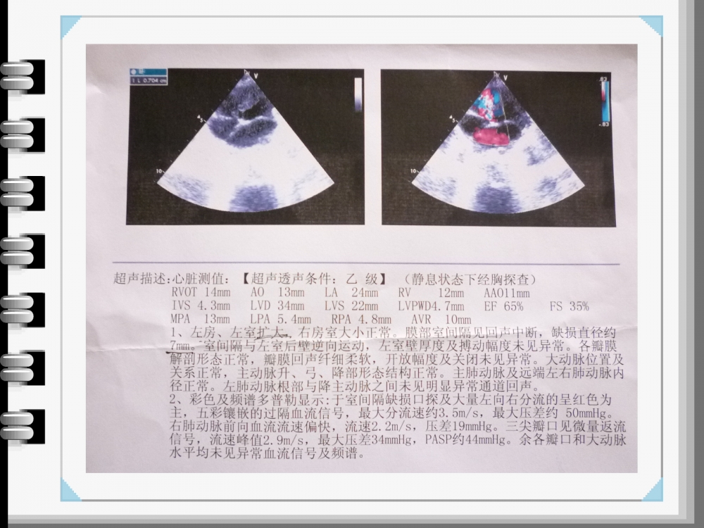 心超報告.JPG