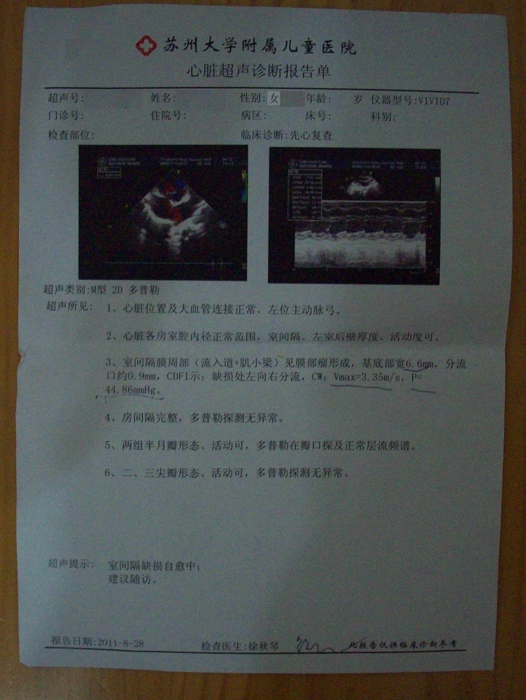 25个月心超.JPG
