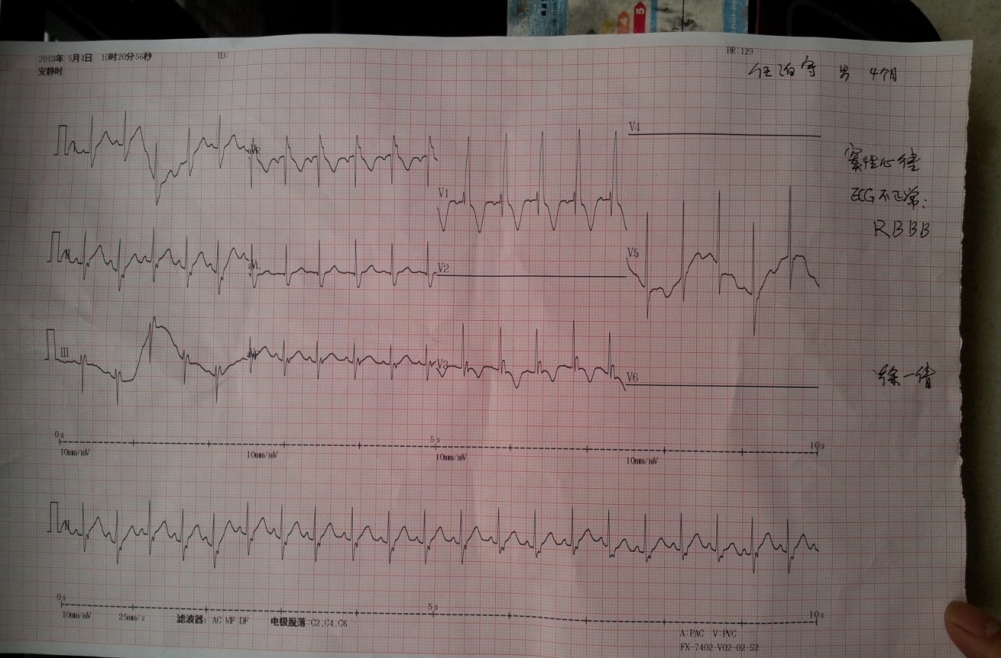 心电图.jpg