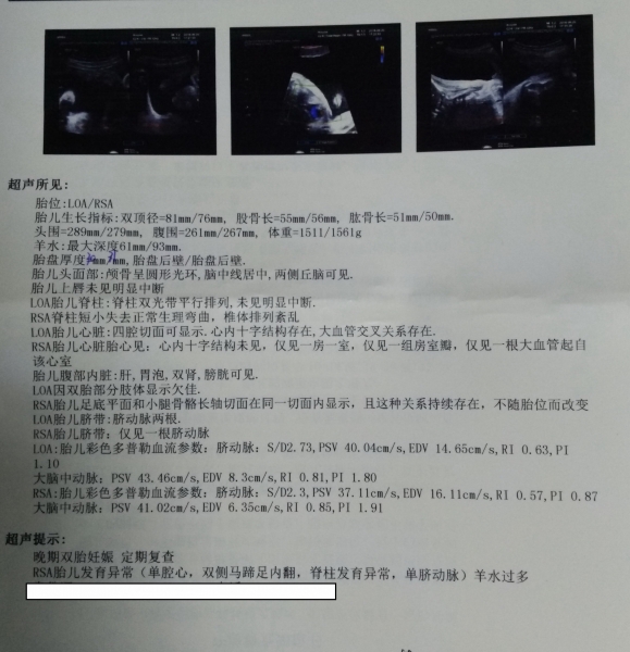 三维彩超